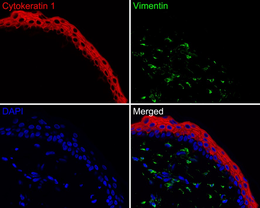 Immunofluorescence analysis of paraffin-embedded human skin tissue labeling Cytokeratin 1 (HA720141F) and Vimentin (EM0401).<br />
<br />
The section was pre-treated using heat mediated antigen retrieval with Tris-EDTA buffer (pH 9.0) for 20 minutes. The tissues were blocked in 10% negative goat serum for 1 hour at room temperature, washed with PBS. And then probed with the primary antibodies Cytokeratin 1 (HA720141F, red) at 1/100 dilution and Vimentin (EM0401, green) at 1/1,000 dilution overnight at 4 ℃, washed with PBS.<br />
<br />
iFluor™ 488 conjugate-Goat anti-Mouse IgG (HA1125) was used as the secondary antibody at 1/1,000 dilution. DAPI was used as nuclear counterstain.