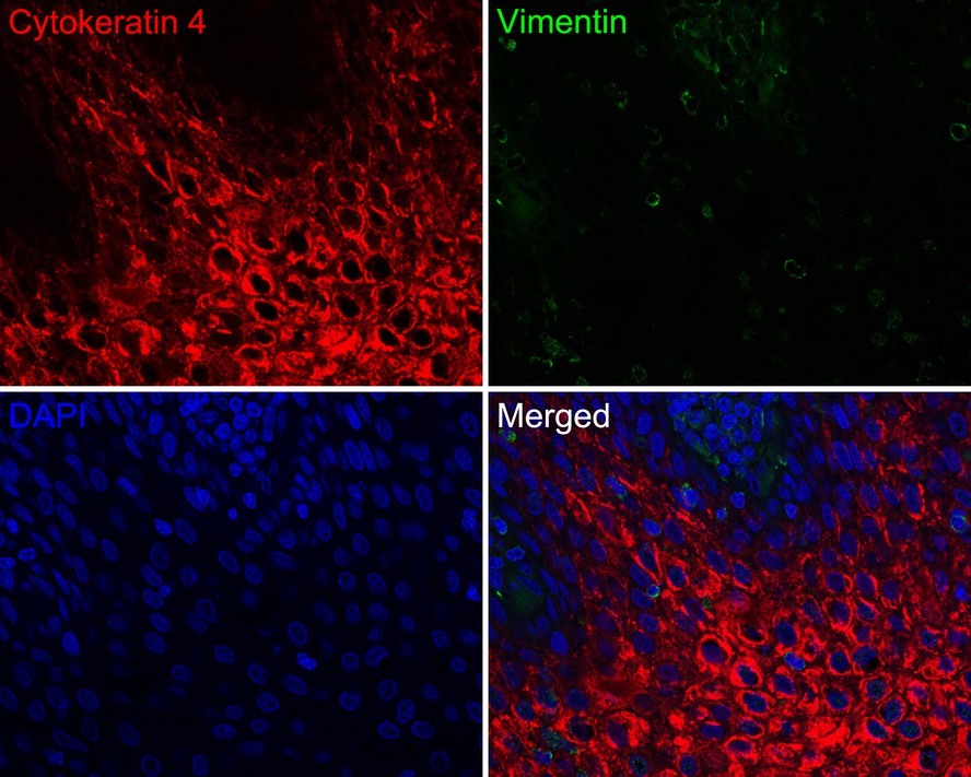 Immunofluorescence analysis of paraffin-embedded human tonsil tissue labeling Cytokeratin 4 (HA720142F) and Vimentin (EM0401).<br />
<br />
The section was pre-treated using heat mediated antigen retrieval with Tris-EDTA buffer (pH 9.0) for 20 minutes. The tissues were blocked in 10% negative goat serum for 1 hour at room temperature, washed with PBS. And then probed with the primary antibodies Cytokeratin 4 (HA720142F, red) at 1/200 dilution and Vimentin (EM0401, green) at 1/1,000 dilution overnight at 4 ℃, washed with PBS.<br />
<br />
iFluor™ 488 conjugate-Goat anti-Mouse IgG (HA1125) was used as the secondary antibody at 1/1,000 dilution. DAPI was used as nuclear counterstain.