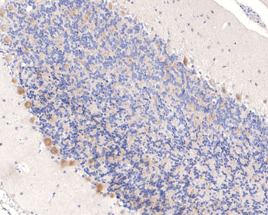 Immunohistochemical analysis of paraffin-embedded rat cerebellum tissue with Rabbit anti-IKK gamma antibody (ET1704-40) at 1/400 dilution.<br />
<br />
The section was pre-treated using heat mediated antigen retrieval with sodium citrate buffer (pH 6.0) for 2 minutes. The tissues were blocked in 1% BSA for 20 minutes at room temperature, washed with ddH2O and PBS, and then probed with the primary antibody (ET1704-40) at 1/400 dilution for 1 hour at room temperature. The detection was performed using an HRP conjugated compact polymer system. DAB was used as the chromogen. Tissues were counterstained with hematoxylin and mounted with DPX.
