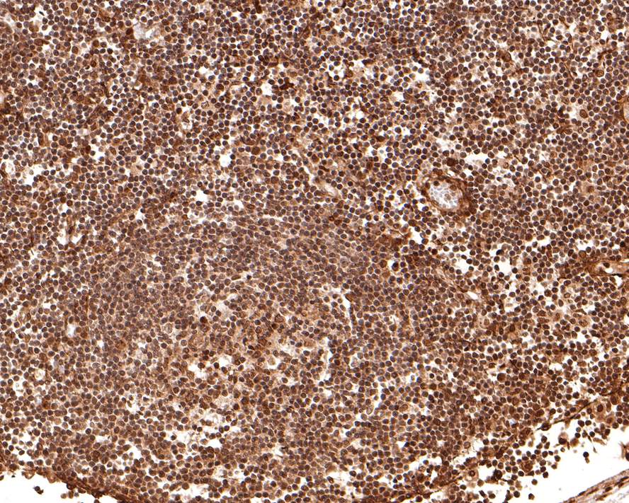 Immunohistochemical analysis of paraffin-embedded human lymph node tissue with Rabbit anti-CRM1 antibody (ET7107-27) at 1/100 dilution.<br />
<br />
The section was pre-treated using heat mediated antigen retrieval with sodium citrate buffer (pH 6.0) for 2 minutes. The tissues were blocked in 1% BSA for 20 minutes at room temperature, washed with ddH2O and PBS, and then probed with the primary antibody (ET7107-27) at 1/100 dilution for 1 hour at room temperature. The detection was performed using an HRP conjugated compact polymer system. DAB was used as the chromogen. Tissues were counterstained with hematoxylin and mounted with DPX.