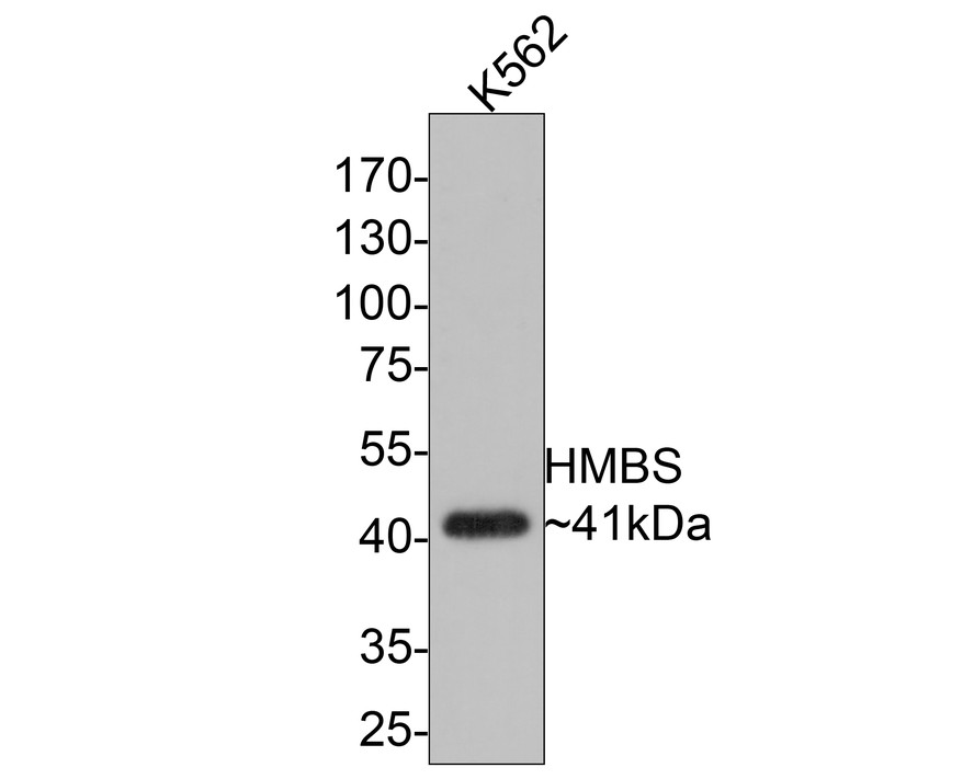 Western blot analysis of HMBS on K562 cell lysates with Rabbit anti-HMBS antibody (ET1610-91) at 1/500 dilution.<br />
<br />
Lysates/proteins at 10 µg/Lane.<br />
<br />
Predicted band size: 39 kDa<br />
Observed band size: 41 kDa<br />
<br />
Exposure time: 30 seconds;<br />
<br />
10% SDS-PAGE gel.<br />
<br />
Proteins were transferred to a PVDF membrane and blocked with 5% NFDM/TBST for 1 hour at room temperature. The primary antibody (ET1610-91) at 1/500 dilution was used in 5% NFDM/TBST at room temperature for 2 hours. Goat Anti-Rabbit IgG - HRP Secondary Antibody (HA1001) at 1:200,000 dilution was used for 1 hour at room temperature.