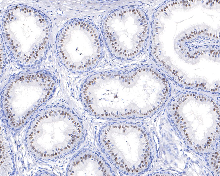 Immunohistochemical analysis of paraffin-embedded rat epididymis tissue with Rabbit anti-Pax2 antibody (ET1701-23) at 1/100 dilution.<br />
<br />
The section was pre-treated using heat mediated antigen retrieval with sodium citrate buffer (pH 6.0) for 2 minutes. The tissues were blocked in 1% BSA for 20 minutes at room temperature, washed with ddH2O and PBS, and then probed with the primary antibody (ET1701-23) at 1/100 dilution for 1 hour at room temperature. The detection was performed using an HRP conjugated compact polymer system. DAB was used as the chromogen. Tissues were counterstained with hematoxylin and mounted with DPX.