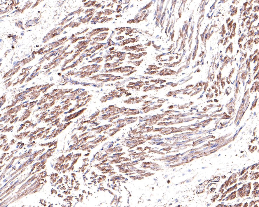 Immunohistochemical analysis of paraffin-embedded human fetal skeletal muscle tissue with Rabbit anti-Actin antibody (ET1702-52) at 1/400 dilution.<br />
<br />
The section was pre-treated using heat mediated antigen retrieval with Tris-EDTA buffer (pH 9.0) for 20 minutes. The tissues were blocked in 1% BSA for 20 minutes at room temperature, washed with ddH2O and PBS, and then probed with the primary antibody (ET1702-52) at 1/400 dilution for 1 hour at room temperature. The detection was performed using an HRP conjugated compact polymer system. DAB was used as the chromogen. Tissues were counterstained with hematoxylin and mounted with DPX.