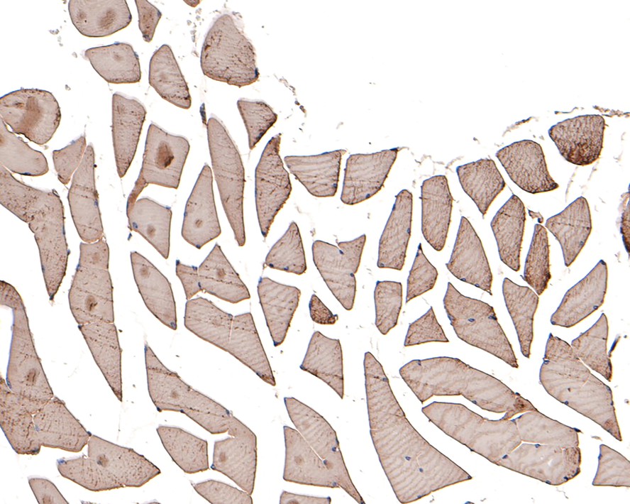 Immunohistochemical analysis of paraffin-embedded mouse skeletal muscle tissue with Rabbit anti-Actin antibody (ET1702-52) at 1/400 dilution.<br />
<br />
The section was pre-treated using heat mediated antigen retrieval with Tris-EDTA buffer (pH 9.0) for 20 minutes. The tissues were blocked in 1% BSA for 20 minutes at room temperature, washed with ddH2O and PBS, and then probed with the primary antibody (ET1702-52) at 1/400 dilution for 1 hour at room temperature. The detection was performed using an HRP conjugated compact polymer system. DAB was used as the chromogen. Tissues were counterstained with hematoxylin and mounted with DPX.