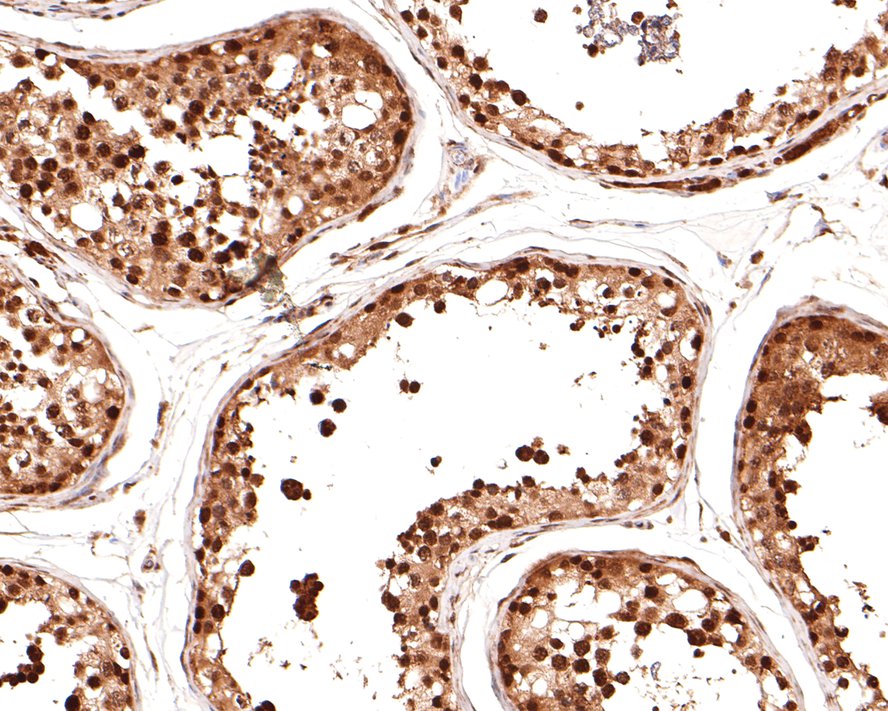 Immunohistochemical analysis of paraffin-embedded human testis tissue with Rabbit anti-NEDD8 antibody (ET1702-84) at 1/400 dilution.<br />
<br />
The section was pre-treated using heat mediated antigen retrieval with sodium citrate buffer (pH 6.0) for 2 minutes. The tissues were blocked in 1% BSA for 20 minutes at room temperature, washed with ddH2O and PBS, and then probed with the primary antibody (ET1702-84) at 1/400 dilution for 1 hour at room temperature. The detection was performed using an HRP conjugated compact polymer system. DAB was used as the chromogen. Tissues were counterstained with hematoxylin and mounted with DPX.