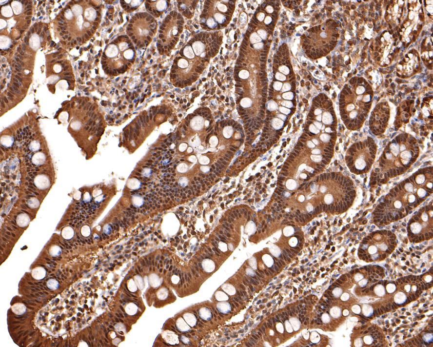 Immunohistochemical analysis of paraffin-embedded human small intestine tissue with Rabbit anti-Thioredoxin antibody (ET1702-90) at 1/400 dilution.<br />
<br />
The section was pre-treated using heat mediated antigen retrieval with sodium citrate buffer (pH 6.0) for 2 minutes. The tissues were blocked in 1% BSA for 20 minutes at room temperature, washed with ddH2O and PBS, and then probed with the primary antibody (ET1702-90) at 1/400 dilution for 1 hour at room temperature. The detection was performed using an HRP conjugated compact polymer system. DAB was used as the chromogen. Tissues were counterstained with hematoxylin and mounted with DPX.