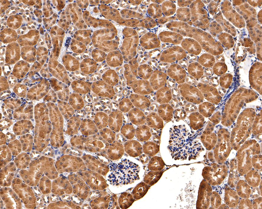 Immunohistochemical analysis of paraffin-embedded mouse kidney tissue with Rabbit anti-Thioredoxin antibody (ET1702-90) at 1/400 dilution.<br />
<br />
The section was pre-treated using heat mediated antigen retrieval with sodium citrate buffer (pH 6.0) for 2 minutes. The tissues were blocked in 1% BSA for 20 minutes at room temperature, washed with ddH2O and PBS, and then probed with the primary antibody (ET1702-90) at 1/400 dilution for 1 hour at room temperature. The detection was performed using an HRP conjugated compact polymer system. DAB was used as the chromogen. Tissues were counterstained with hematoxylin and mounted with DPX.