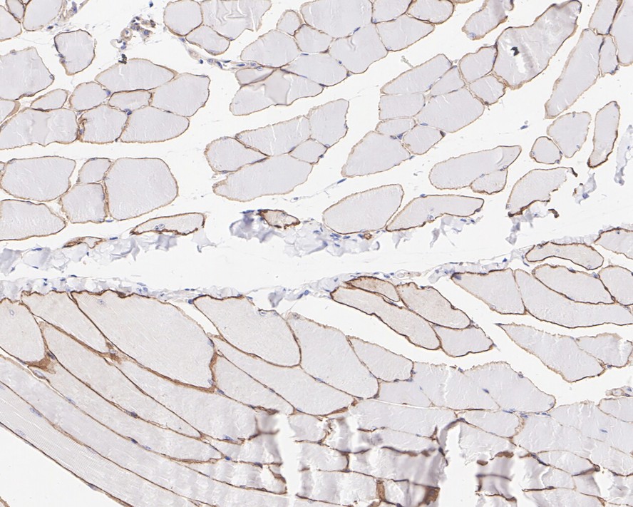 Immunohistochemical analysis of paraffin-embedded mouse skeletal muscle tissue with Rabbit anti-Dystrophin antibody (ET1702-98) at 1/1,000 dilution.<br />
<br />
The section was pre-treated using heat mediated antigen retrieval with Tris-EDTA buffer (pH 9.0) for 20 minutes. The tissues were blocked in 1% BSA for 20 minutes at room temperature, washed with ddH2O and PBS, and then probed with the primary antibody (ET1702-98) at 1/1,000 dilution for 1 hour at room temperature. The detection was performed using an HRP conjugated compact polymer system. DAB was used as the chromogen. Tissues were counterstained with hematoxylin and mounted with DPX.