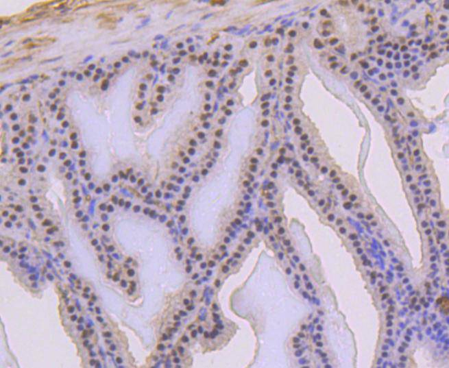 Immunohistochemical analysis of paraffin-embedded mouse prostate tissue using anti-Phospho-p53 (S392) antibody. The section was pre-treated using heat mediated antigen retrieval with Tris-EDTA buffer (pH 8.0-8.4) for 20 minutes.The tissues were blocked in 5% BSA for 30 minutes at room temperature, washed with ddH2O and PBS, and then probed with the primary antibody (ET1606-24, 1/50) for 30 minutes at room temperature. The detection was performed using an HRP conjugated compact polymer system. DAB was used as the chromogen. Tissues were counterstained with hematoxylin and mounted with DPX.