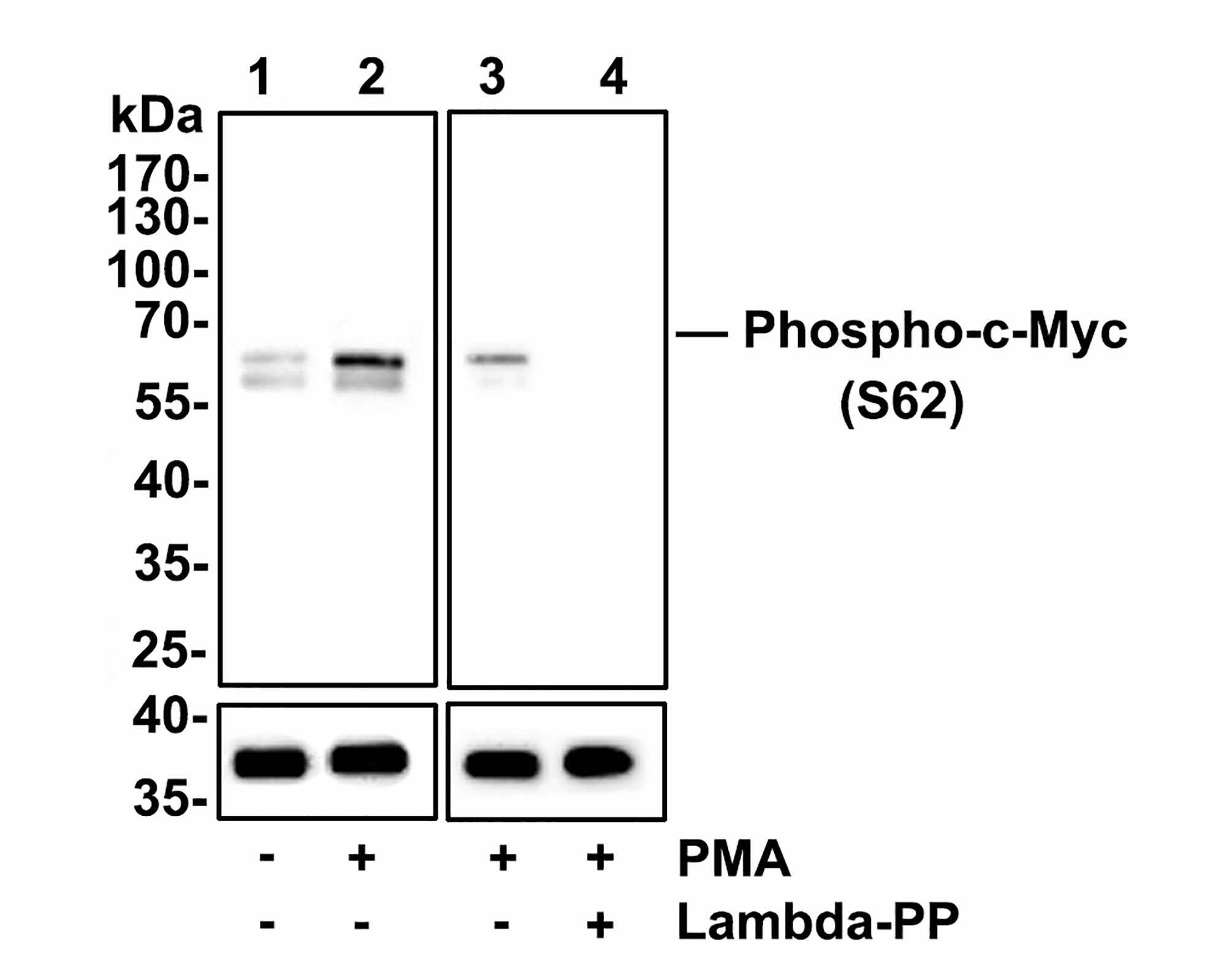 Western blot analysis of Phospho-c-Myc(S62) on Hela cell lysates.<br />
<br />
Lane 1: Hela cells, whole cell lysate, 10ug/lane<br />
Lane 2/3: Hela cells treated with 200 nM PMA for 10 minutes, whole cell lysates, 10ug/lane<br />
Lane 4:  Hela cells treated with 200 nM PMA for 10 minutes, then treated with 2.8ug/ul lambda-PP for 30 minutes, whole cell lysates, 10ug/lane<br />
<br />
All lanes :<br />
Anti-Phospho-c-Myc(S62) antibody (ET1609-64<br />
) at 1:500 dilution. Anti-GAPDH antibody (ET1601-4) at 1:10,000 dilution. Goat Anti-Rabbit IgG H&L (HRP) (HA1001) at 1/200,000 dilution.<br />
<br />
Predicted band size: 57 kDa<br />
Observed band size:60 kDa<br />
<br />
Blocking and diluting buffer: 5% BSA.<br />
<br />
Exposure time: 3 minutes