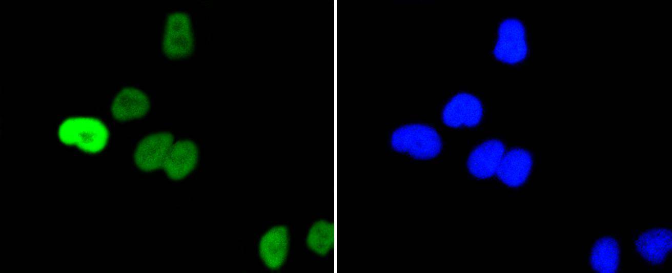 ICC staining of Phospho-c-Myc(S62) in Hela cells (green). Formalin fixed cells were permeabilized with 0.1% Triton X-100 in TBS for 10 minutes at room temperature and blocked with 1% Blocker BSA for 15 minutes at room temperature. Cells were probed with the primary antibody (ET1609-64, 1/50) for 1 hour at room temperature, washed with PBS. Alexa Fluor®488 Goat anti-Rabbit IgG was used as the secondary antibody at 1/1,000 dilution. The nuclear counter stain is DAPI (blue).