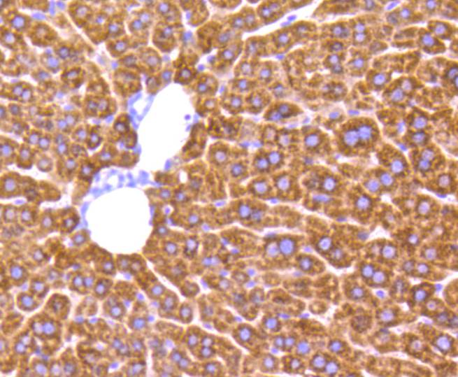 Immunohistochemical analysis of paraffin-embedded mouse liver tissue using anti-MMP2 antibody. Counter stained with hematoxylin.