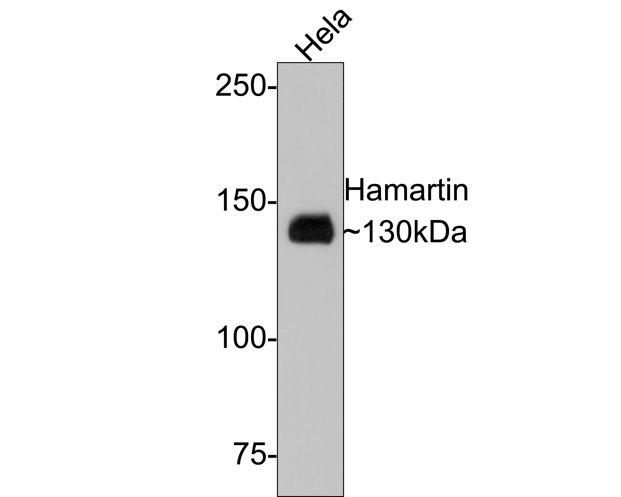 Western blot analysis of Hamartin on Hela cell lysates with Rabbit anti-Hamartin antibody (HA500199) at 1/1,000 dilution.<br />
<br />
Lysates/proteins at 10 µg/Lane.<br />
<br />
Predicted band size: 130 kDa<br />
Observed band size: 130 kDa<br />
<br />
Exposure time: 2 minutes;<br />
<br />
6% SDS-PAGE gel.<br />
<br />
Proteins were transferred to a PVDF membrane and blocked with 5% NFDM/TBST for 1 hour at room temperature. The primary antibody (HA500199) at 1/1,000 dilution was used in 5% NFDM/TBST at room temperature for 2 hours. Goat Anti-Rabbit IgG - HRP Secondary Antibody (HA1001) at 1:300,000 dilution was used for 1 hour at room temperature.