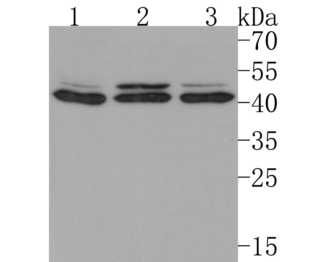Western blot analysis of IL-10RB on different lysates with Rabbit anti-IL-10RB antibody (HA500322) at 1/500 dilution.<br />
<br />
Lane 1: 293T cell lysate<br />
Lane 2: Jurkat cell lysate<br />
Lane 3: Hela cell lysate<br />
<br />
Lysates/proteins at 10 µg/Lane.<br />
<br />
Predicted band size: 37 kDa<br />
Observed band size: 42 kDa (Glycoprotein)<br />
<br />
Exposure time: 2 minutes;<br />
<br />
12% SDS-PAGE gel.<br />
<br />
Proteins were transferred to a PVDF membrane and blocked with 5% NFDM/TBST for 1 hour at room temperature. The primary antibody (HA500322) at 1/500 dilution was used in 5% NFDM/TBST at room temperature for 2 hours. Goat Anti-Rabbit IgG - HRP Secondary Antibody (HA1001) at 1:200,000 dilution was used for 1 hour at room temperature.