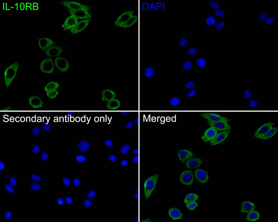 Immunocytochemistry analysis of SiHa cells labeling IL-10RB with Rabbit anti-IL-10RB antibody (HA500322) at 1/200 dilution.<br />
<br />
Cells were fixed in 4% paraformaldehyde for 10 minutes at 37 ℃, and then blocked with 2% negative goat serum for 30 minutes at room temperature. Cells were then incubated with Rabbit anti-IL-10RB antibody (HA500322) at 1/200 dilution in 2% negative goat serum overnight at 4 ℃. Goat Anti-Rabbit IgG H&L (Alexa Fluor® 488) was used as the secondary antibody at 1/1,000 dilution. PBS instead of the primary antibody was used as the secondary antibody only control. Nuclear DNA was labelled in blue with DAPI.
