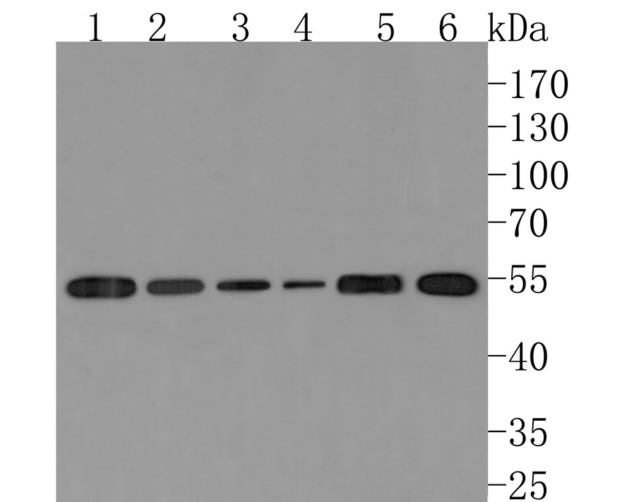 Western blot analysis of ALDH7A1 on different lysates with Rabbit anti-ALDH7A1 antibody (HA720086) at 1/500 dilution.<br />
<br />
Lane 1: Hela cell lysate, 10 µg/Lane<br />
Lane 2: HepG2 cell lysate, 10 µg/Lane<br />
Lane 3: 293T cell lysate, 10 µg/Lane<br />
Lane 4: A431 cell lysate, 10 µg/Lane<br />
Lane 5: Mouse liver tissue lysate, 20 µg/Lane<br />
Lane 6: Mouse kidney tissue lysate, 20 µg/Lane<br />
<br />
Predicted band size: 58 kDa<br />
Observed band size: 55 kDa <br />
<br />
Exposure time: 2 minutes;<br />
<br />
10% SDS-PAGE gel.<br />
<br />
Proteins were transferred to a PVDF membrane and blocked with 5% NFDM/TBST for 1 hour at room temperature. The primary antibody (HA720086) at 1/500 dilution was used in 5% NFDM/TBST at room temperature for 2 hours. Goat Anti-Rabbit IgG - HRP Secondary Antibody (HA1001) at 1:200,000 dilution was used for 1 hour at room temperature.
