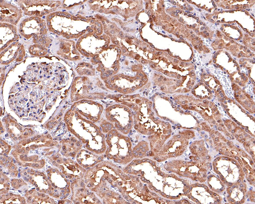 Immunohistochemical analysis of paraffin-embedded human kidney tissue with Rabbit anti-ALDH7A1 antibody (HA720086) at 1/500 dilution.<br />
<br />
The section was pre-treated using heat mediated antigen retrieval with Tris-EDTA buffer (pH 9.0) for 20 minutes. The tissues were blocked in 1% BSA for 20 minutes at room temperature, washed with ddH2O and PBS, and then probed with the primary antibody (HA720086) at 1/500 dilution for 1 hour at room temperature. The detection was performed using an HRP conjugated compact polymer system. DAB was used as the chromogen. Tissues were counterstained with hematoxylin and mounted with DPX.
