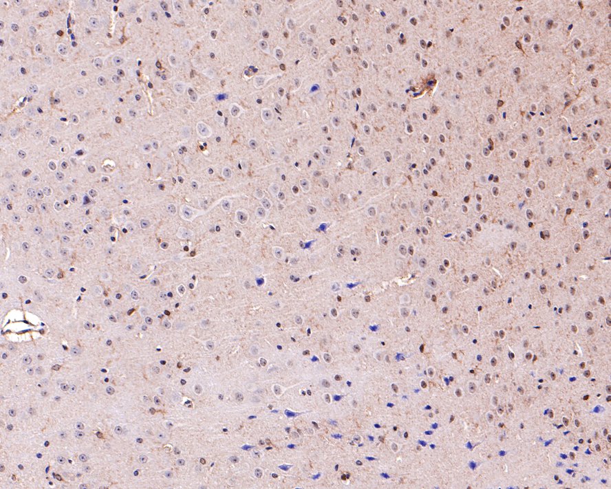 Immunohistochemical analysis of paraffin-embedded mouse brain tissue with Rabbit anti-ALDH7A1 antibody (HA720086) at 1/1,000 dilution.<br />
<br />
The section was pre-treated using heat mediated antigen retrieval with Tris-EDTA buffer (pH 9.0) for 20 minutes. The tissues were blocked in 1% BSA for 20 minutes at room temperature, washed with ddH2O and PBS, and then probed with the primary antibody (HA720086) at 1/1,000 dilution for 1 hour at room temperature. The detection was performed using an HRP conjugated compact polymer system. DAB was used as the chromogen. Tissues were counterstained with hematoxylin and mounted with DPX.