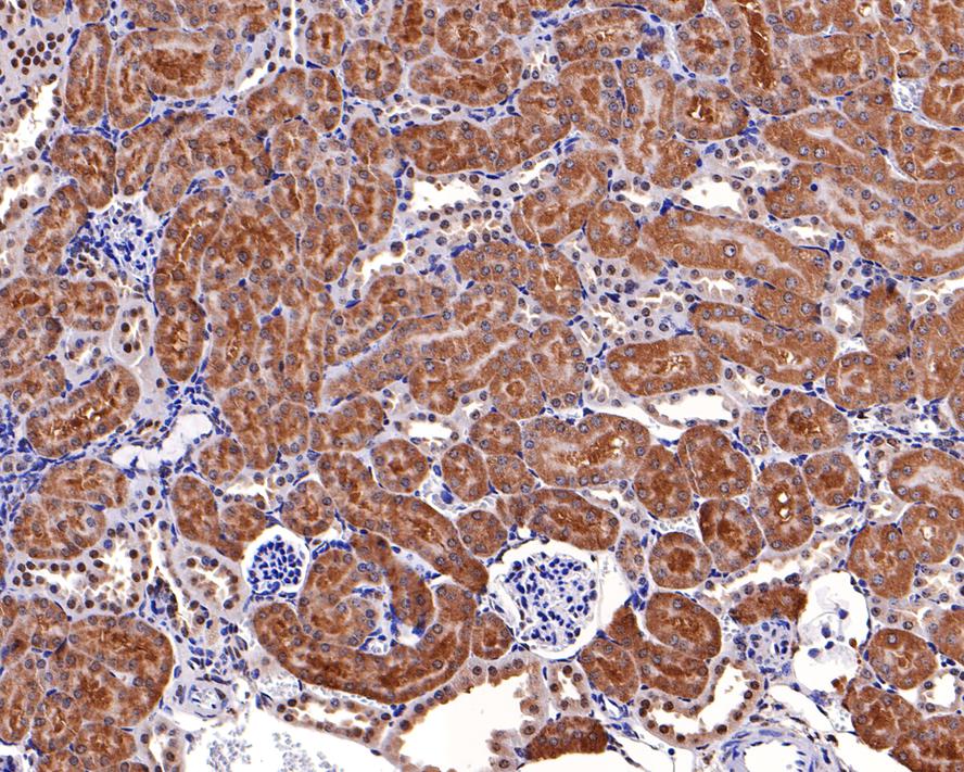 Immunohistochemical analysis of paraffin-embedded mouse kidney tissue with Rabbit anti-ALDH7A1 antibody (HA720086) at 1/500 dilution.<br />
<br />
The section was pre-treated using heat mediated antigen retrieval with Tris-EDTA buffer (pH 9.0) for 20 minutes. The tissues were blocked in 1% BSA for 20 minutes at room temperature, washed with ddH2O and PBS, and then probed with the primary antibody (HA720086) at 1/500 dilution for 1 hour at room temperature. The detection was performed using an HRP conjugated compact polymer system. DAB was used as the chromogen. Tissues were counterstained with hematoxylin and mounted with DPX.