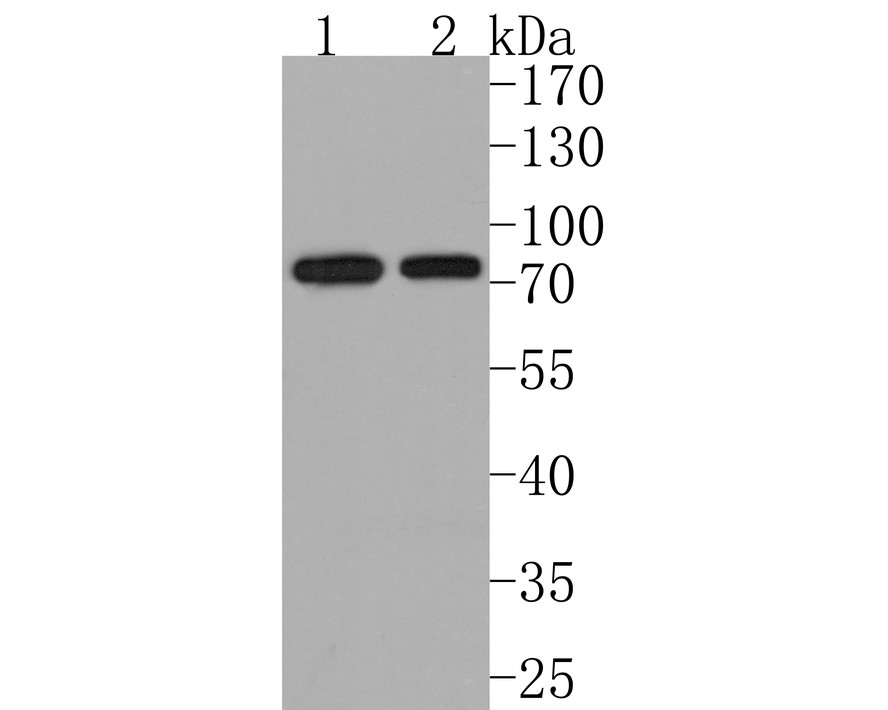 Western blot analysis of CTPS on different lysates with Rabbit anti-CTPS antibody (HA721003) at 1/500 dilution.<br />
<br />
Lane 1: NIH/3T3 cell lysate, 10 µg/Lane<br />
Lane 2: Mouse spleen tissue lysate, 20 µg/Lane<br />
<br />
Predicted band size: 67 kDa<br />
Observed band size: 75 kDa<br />
<br />
Exposure time: 1 minute;<br />
<br />
10% SDS-PAGE gel.<br />
<br />
Proteins were transferred to a PVDF membrane and blocked with 5% NFDM/TBST for 1 hour at room temperature. The primary antibody (HA721003) at 1/500 dilution was used in 5% NFDM/TBST at room temperature for 2 hours. Goat Anti-Rabbit IgG - HRP Secondary Antibody (HA1001) at 1:200,000 dilution was used for 1 hour at room temperature.