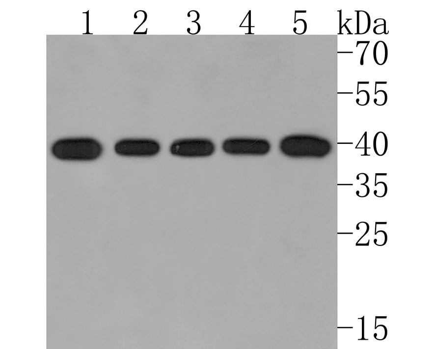 Western blot analysis of GNA13 on different lysates with Rabbit anti-GNA13 antibody (HA721007) at 1/500 dilution.<br />
<br />
Lane 1: 293T cell lysate<br />
Lane 2: HepG2 cell lysate<br />
Lane 3: 293 cell lysate<br />
Lane 4: Jurkat cell lysate<br />
Lane 5: PC-12 cell lysate<br />
<br />
Lysates/proteins at 10 µg/Lane.<br />
<br />
Predicted band size: 44 kDa<br />
Observed band size: 40 kDa<br />
<br />
Exposure time: 2 minutes;<br />
<br />
12% SDS-PAGE gel.<br />
<br />
Proteins were transferred to a PVDF membrane and blocked with 5% NFDM/TBST for 1 hour at room temperature. The primary antibody (HA721007) at 1/500 dilution was used in 5% NFDM/TBST at room temperature for 2 hours. Goat Anti-Rabbit IgG - HRP Secondary Antibody (HA1001) at 1:200,000 dilution was used for 1 hour at room temperature.