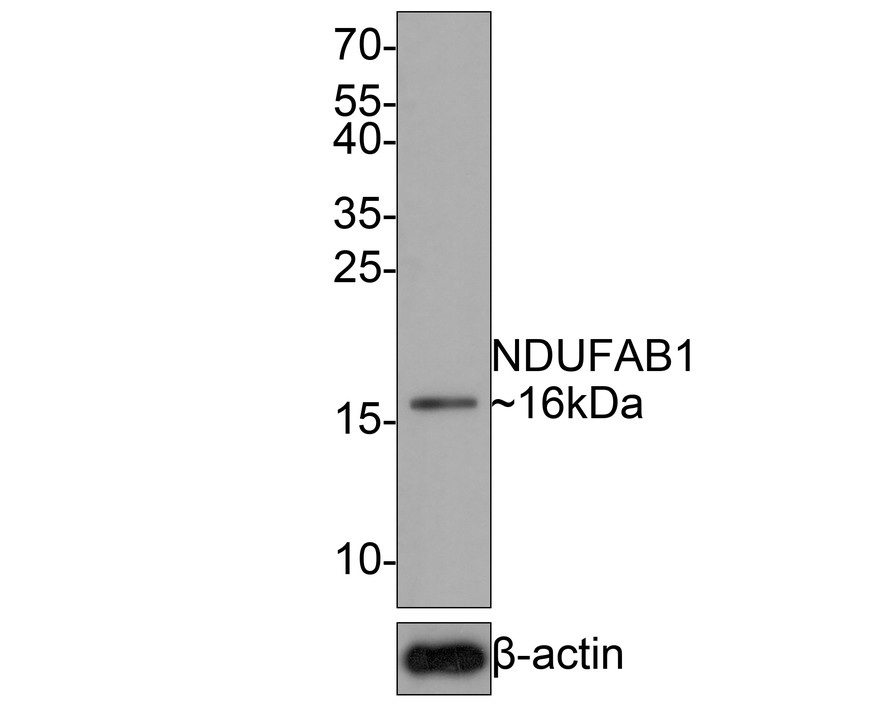 Western blot analysis of NDUFAB1 on human small intestine tissue lysates with Rabbit anti-NDUFAB1 antibody (HA720088) at 1/500 dilution.<br />
<br />
Lysates/proteins at 20 µg/Lane.<br />
<br />
Predicted band size: 17 kDa<br />
Observed band size: 16 kDa<br />
<br />
Exposure time: 2 minutes;<br />
<br />
15% SDS-PAGE gel.<br />
<br />
Proteins were transferred to a PVDF membrane and blocked with 5% NFDM/TBST for 1 hour at room temperature. The primary antibody (HA720088) at 1/500 dilution was used in 5% NFDM/TBST at room temperature for 2 hours. Goat Anti-Rabbit IgG - HRP Secondary Antibody (HA1001) at 1:200,000 dilution was used for 1 hour at room temperature.