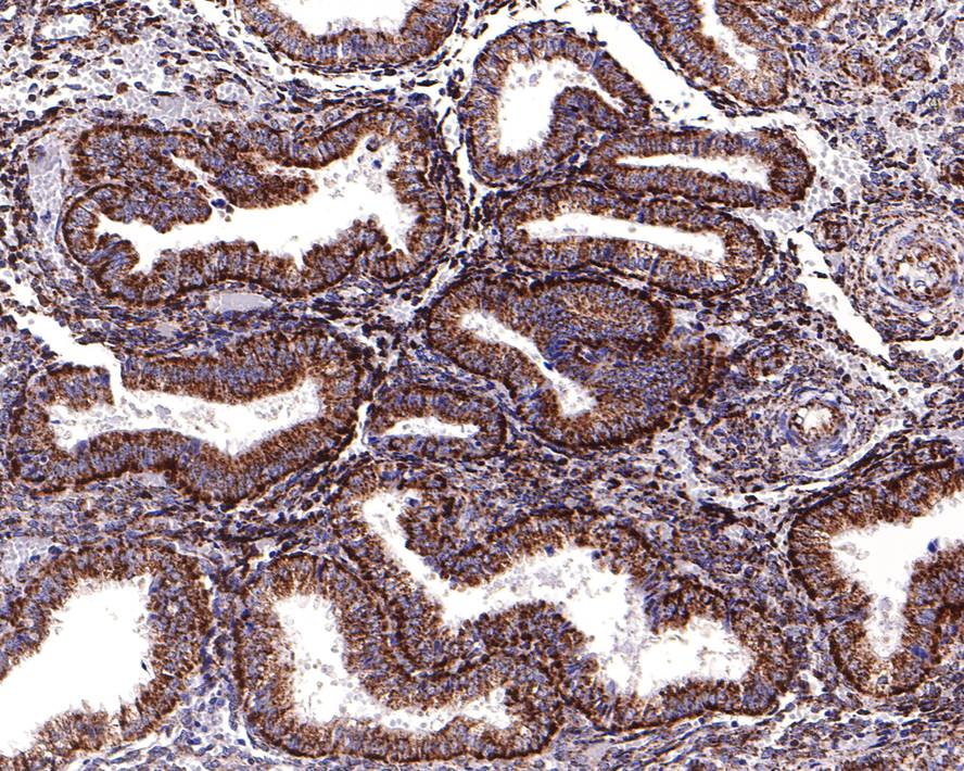 Immunohistochemical analysis of paraffin-embedded human endometrium tissue with Rabbit anti-NDUFAB1 antibody (HA720088) at 1/100 dilution.<br />
<br />
The section was pre-treated using heat mediated antigen retrieval with Tris-EDTA buffer (pH 9.0) for 20 minutes. The tissues were blocked in 1% BSA for 20 minutes at room temperature, washed with ddH2O and PBS, and then probed with the primary antibody (HA720088) at 1/100 dilution for 1 hour at room temperature. The detection was performed using an HRP conjugated compact polymer system. DAB was used as the chromogen. Tissues were counterstained with hematoxylin and mounted with DPX.