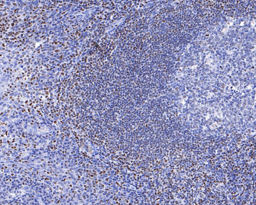 Immunohistochemical analysis of paraffin-embedded human tonsils tissue with Mouse anti-RUNX3 antibody (HA600058) at 1/600 dilution.<br />
<br />
The section was pre-treated using heat mediated antigen retrieval with sodium citrate buffer (pH 6.0) for 2 minutes. The tissues were blocked in 1% BSA for 20 minutes at room temperature, washed with ddH2O and PBS, and then probed with the primary antibody (HA600058) at 1/600 dilution for 1 hour at room temperature. The detection was performed using an HRP conjugated compact polymer system. DAB was used as the chromogen. Tissues were counterstained with hematoxylin and mounted with DPX.