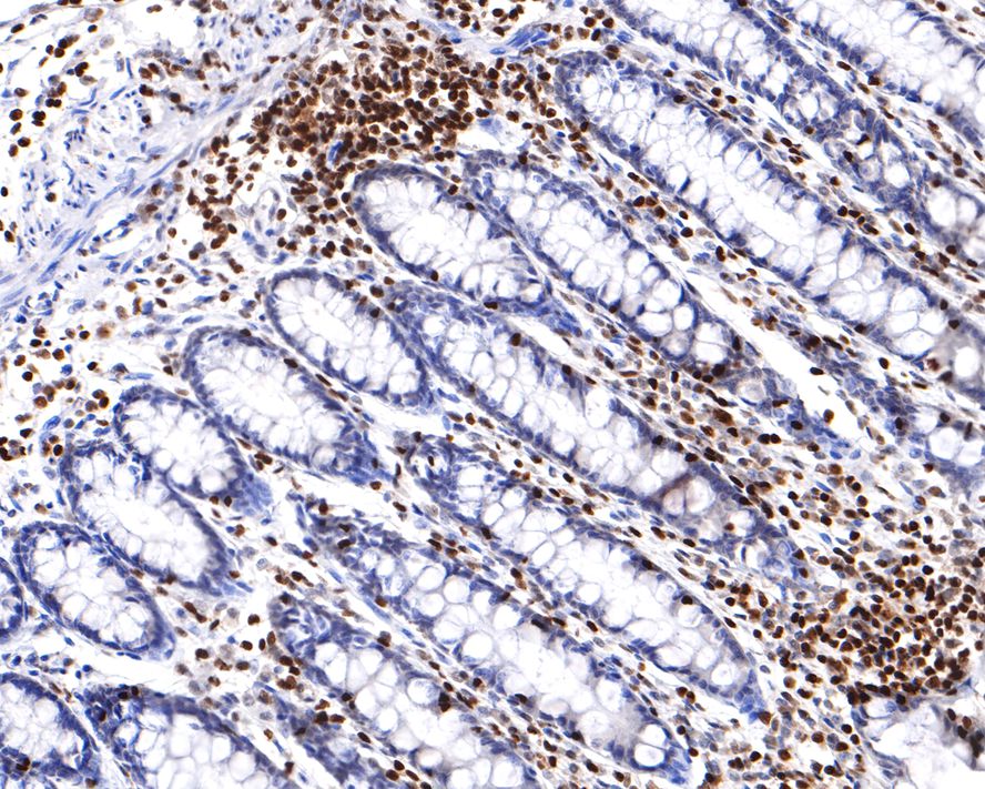 Immunohistochemical analysis of paraffin-embedded human colon tissue with Mouse anti-RUNX3 antibody (HA600058) at 1/600 dilution.<br />
<br />
The section was pre-treated using heat mediated antigen retrieval with sodium citrate buffer (pH 6.0) for 2 minutes. The tissues were blocked in 1% BSA for 20 minutes at room temperature, washed with ddH2O and PBS, and then probed with the primary antibody (HA600058) at 1/600 dilution for 1 hour at room temperature. The detection was performed using an HRP conjugated compact polymer system. DAB was used as the chromogen. Tissues were counterstained with hematoxylin and mounted with DPX.