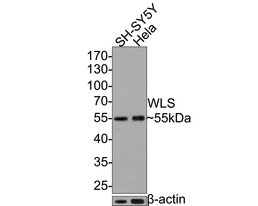 Western blot analysis of WLS on different lysates with Mouse anti-WLS antibody (HA600060) at 1/20,000 dilution.<br />
<br />
Lane 1: SH-SY5Y cell lysate<br />
Lane 2: Hela cell lysate<br />
<br />
Lysates/proteins at 10 µg/Lane.<br />
<br />
Predicted band size: 62 kDa<br />
Observed band size: 55 kDa<br />
<br />
Exposure time: 30 seconds;<br />
<br />
10% SDS-PAGE gel.<br />
<br />
Proteins were transferred to a PVDF membrane and blocked with 5% NFDM/TBST for 1 hour at room temperature. The primary antibody (HA600060) at 1/20,000 dilution was used in 5% NFDM/TBST at room temperature for 2 hours. Goat Anti-Mouse IgG - HRP Secondary Antibody (HA1006) at 1:100,000 dilution was used for 1 hour at room temperature.