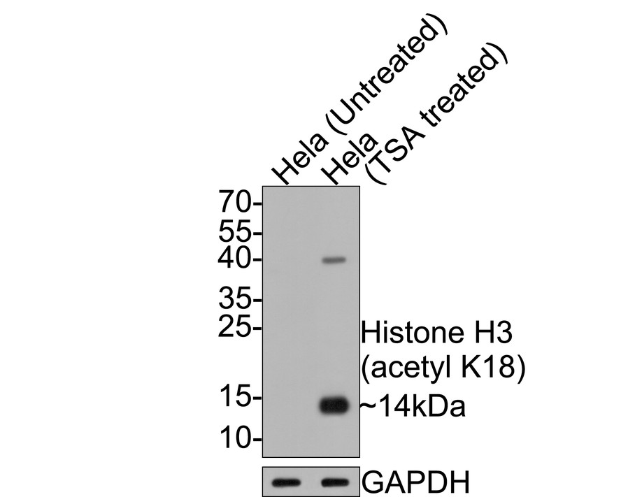 Western blot analysis of Histone H3 (acetyl K18) on different lysates with Mouse anti-Histone H3 (acetyl K18) antibody (HA600090) at 1/2,000 dilution.<br />
<br />
Lane 1: Hela cell lysate<br />
Lane 2: Hela treated with TSA cell lysate<br />
<br />
Lysates/proteins at 10 µg/Lane.<br />
<br />
Predicted band size: 15 kDa<br />
Observed band size: 14/40 kDa<br />
<br />
Exposure time: 30 seconds;<br />
<br />
15% SDS-PAGE gel.<br />
<br />
Proteins were transferred to a PVDF membrane and blocked with 5% NFDM/TBST for 1 hour at room temperature. The primary antibody (HA600090) at 1/2,000 dilution was used in 5% NFDM/TBST at room temperature for 2 hours. Goat Anti-Mouse IgG - HRP Secondary Antibody (HA1006) at 1:100,000 dilution was used for 1 hour at room temperature.