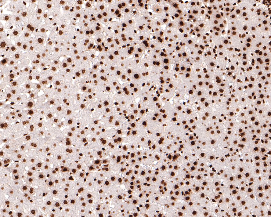 Immunohistochemical analysis of paraffin-embedded rat liver tissue with Mouse anti-Histone H3 (acetyl K18) antibody (HA600090) at 1/500 dilution.<br />
<br />
The section was pre-treated using heat mediated antigen retrieval with sodium citrate buffer (pH 6.0) for 2 minutes. The tissues were blocked in 1% BSA for 20 minutes at room temperature, washed with ddH2O and PBS, and then probed with the primary antibody (HA600090) at 1/500 dilution for 1 hour at room temperature. The detection was performed using an HRP conjugated compact polymer system. DAB was used as the chromogen. Tissues were counterstained with hematoxylin and mounted with DPX.