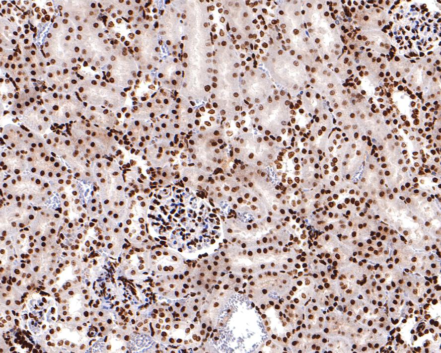 Immunohistochemical analysis of paraffin-embedded rat kidney tissue with Mouse anti-Histone H3 (acetyl K18) antibody (HA600090) at 1/500 dilution.<br />
<br />
The section was pre-treated using heat mediated antigen retrieval with sodium citrate buffer (pH 6.0) for 2 minutes. The tissues were blocked in 1% BSA for 20 minutes at room temperature, washed with ddH2O and PBS, and then probed with the primary antibody (HA600090) at 1/500 dilution for 1 hour at room temperature. The detection was performed using an HRP conjugated compact polymer system. DAB was used as the chromogen. Tissues were counterstained with hematoxylin and mounted with DPX.