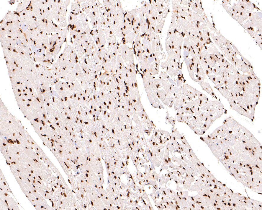 Immunohistochemical analysis of paraffin-embedded rat myocardium tissue with Mouse anti-Histone H3 (acetyl K18) antibody (HA600090) at 1/500 dilution.<br />
<br />
The section was pre-treated using heat mediated antigen retrieval with sodium citrate buffer (pH 6.0) for 2 minutes. The tissues were blocked in 1% BSA for 20 minutes at room temperature, washed with ddH2O and PBS, and then probed with the primary antibody (HA600090) at 1/500 dilution for 1 hour at room temperature. The detection was performed using an HRP conjugated compact polymer system. DAB was used as the chromogen. Tissues were counterstained with hematoxylin and mounted with DPX.