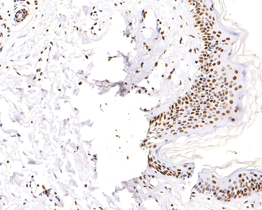 Immunohistochemical analysis of paraffin-embedded human skin tissue with Mouse anti-Histone H3 (acetyl K18) antibody (HA600090) at 1/500 dilution.<br />
<br />
The section was pre-treated using heat mediated antigen retrieval with sodium citrate buffer (pH 6.0) for 2 minutes. The tissues were blocked in 1% BSA for 20 minutes at room temperature, washed with ddH2O and PBS, and then probed with the primary antibody (HA600090) at 1/500 dilution for 1 hour at room temperature. The detection was performed using an HRP conjugated compact polymer system. DAB was used as the chromogen. Tissues were counterstained with hematoxylin and mounted with DPX.