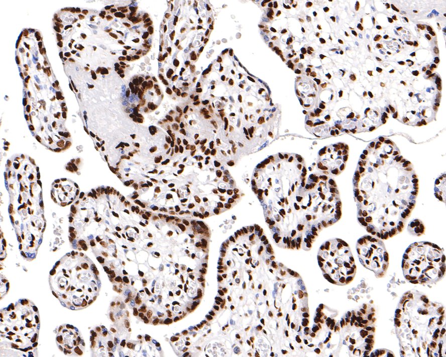 Immunohistochemical analysis of paraffin-embedded human placenta tissue with Mouse anti-Histone H3 (acetyl K18) antibody (HA600090) at 1/500 dilution.<br />
<br />
The section was pre-treated using heat mediated antigen retrieval with sodium citrate buffer (pH 6.0) for 2 minutes. The tissues were blocked in 1% BSA for 20 minutes at room temperature, washed with ddH2O and PBS, and then probed with the primary antibody (HA600090) at 1/500 dilution for 1 hour at room temperature. The detection was performed using an HRP conjugated compact polymer system. DAB was used as the chromogen. Tissues were counterstained with hematoxylin and mounted with DPX.