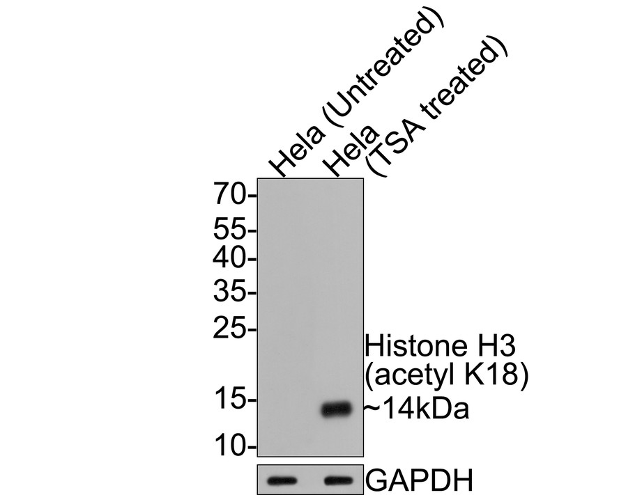 Western blot analysis of Histone H3 (acetyl K18) on different lysates with Mouse anti-Histone H3 (acetyl K18) antibody (HA600091) at 1/2,000 dilution.<br />
<br />
Lane 1: Hela cell lysate<br />
Lane 2: Hela treated with TSA cell lysate<br />
<br />
Lysates/proteins at 10 µg/Lane.<br />
<br />
Predicted band size: 15 kDa<br />
Observed band size: 14 kDa<br />
<br />
Exposure time: 30 seconds;<br />
<br />
15% SDS-PAGE gel.<br />
<br />
Proteins were transferred to a PVDF membrane and blocked with 5% NFDM/TBST for 1 hour at room temperature. The primary antibody (HA600091) at 1/2,000 dilution was used in 5% NFDM/TBST at room temperature for 2 hours. Goat Anti-Mouse IgG - HRP Secondary Antibody (HA1006) at 1:100,000 dilution was used for 1 hour at room temperature.