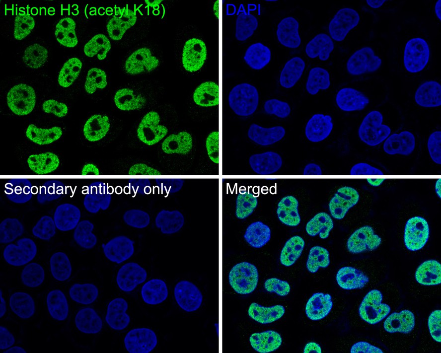 Immunocytochemistry analysis of TSA treated Hela cells labeling Histone H3 (acetyl K18) with Mouse anti-Histone H3 (acetyl K18) antibody (HA600091) at 1/200 dilution.<br />
<br />
Cells were fixed in 4% paraformaldehyde for 30 minutes, permeabilized with 0.1% Triton X-100 in PBS for 15 minutes, and then blocked with 2% BSA for 30 minutes at room temperature. Cells were then incubated with Mouse anti-Histone H3 (acetyl K18) antibody (HA600091) at 1/200 dilution in 2% BSA overnight at 4 ℃. Goat Anti-Mouse IgG H&L (iFluor™ 488, HA1125) was used as the secondary antibody at 1/1,000 dilution. PBS instead of the primary antibody was used as the secondary antibody only control. Nuclear DNA was labelled in blue with DAPI.