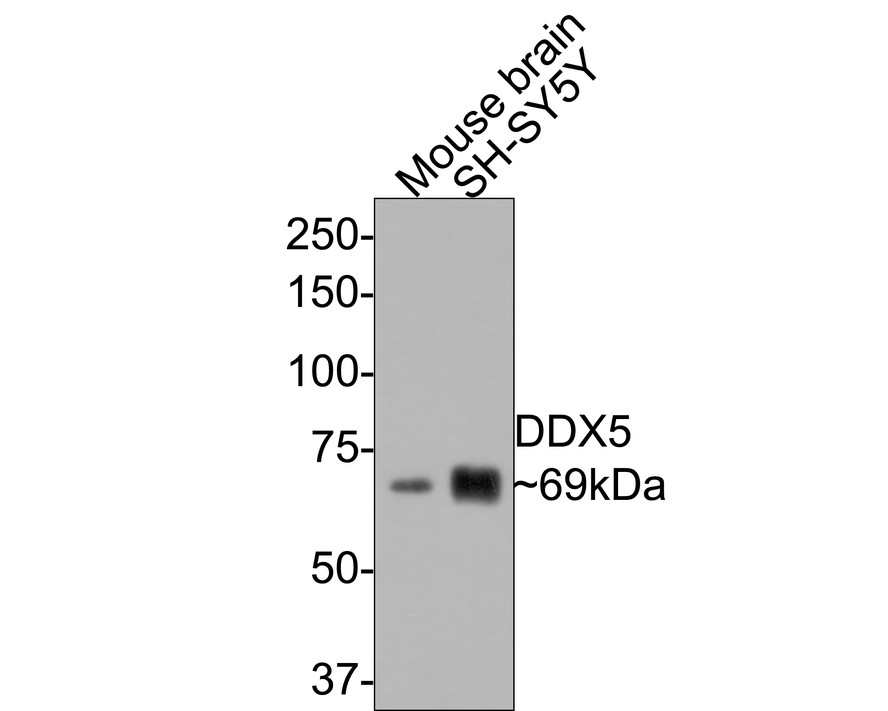 Western blot analysis of DDX5 on different lysates with Rabbit anti-DDX5 antibody (ET1705-32) at 1/1,000 dilution.<br />
<br />
Lane 1: Mouse brain tissue lysate<br />
Lane 2: SH-SY5Y cell lysate (10 µg/Lane)<br />
<br />
Lysates/proteins at 20 µg/Lane.<br />
<br />
Predicted band size: 69 kDa<br />
Observed band size: 69 kDa<br />
<br />
Exposure time: 30 seconds;<br />
<br />
8% SDS-PAGE gel.<br />
<br />
Proteins were transferred to a PVDF membrane and blocked with 5% NFDM/TBST for 1 hour at room temperature. The primary antibody (ET1705-32) at 1/1,000 dilution was used in 5% NFDM/TBST at room temperature for 2 hours. Goat Anti-Rabbit IgG - HRP Secondary Antibody (HA1001) at 1:300,000 dilution was used for 1 hour at room temperature.