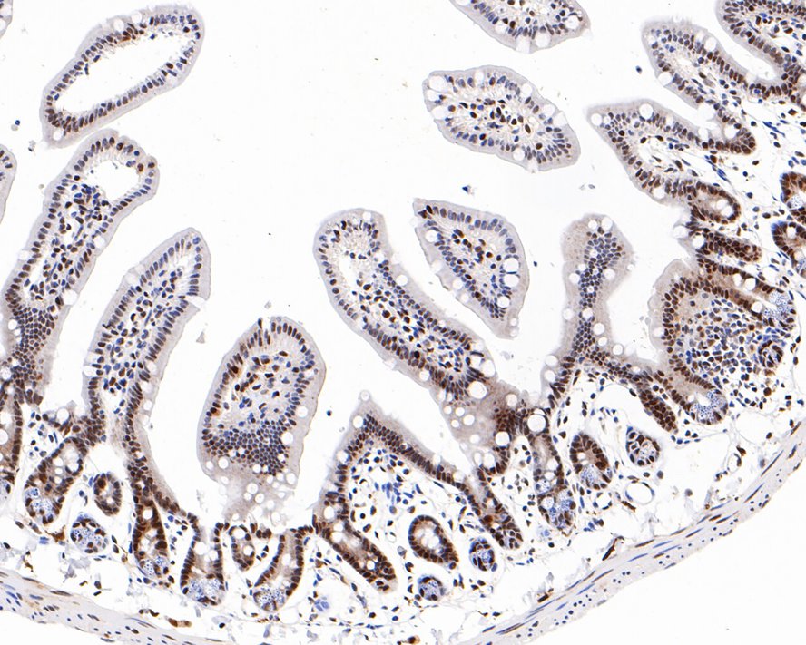 Immunohistochemical analysis of paraffin-embedded mouse large intestine tissue with Rabbit anti-Phospho-ATF2(T71) antibody (ET1610-30) at 1/800 dilution.<br />
<br />
The section was pre-treated using heat mediated antigen retrieval with sodium citrate buffer (pH 6.0) for 2 minutes. The tissues were blocked in 1% BSA for 20 minutes at room temperature, washed with ddH2O and PBS, and then probed with the primary antibody (ET1610-30) at 1/800 dilution for 1 hour at room temperature. The detection was performed using an HRP conjugated compact polymer system. DAB was used as the chromogen. Tissues were counterstained with hematoxylin and mounted with DPX.