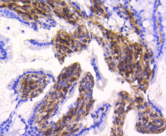 Immunohistochemical analysis of paraffin-embedded human large intestine tissue with Rabbit anti-Vimentin antibody (ET1610-39) at 1/2,000 dilution.<br />
<br />
The section was pre-treated using heat mediated antigen retrieval with Tris-EDTA buffer (pH 9.0) for 20 minutes. The tissues were blocked in 1% BSA for 20 minutes at room temperature, washed with ddH2O and PBS, and then probed with the primary antibody (ET1610-39) at 1/2,000 dilution for 1 hour at room temperature. The detection was performed using an HRP conjugated compact polymer system. DAB was used as the chromogen. Tissues were counterstained with hematoxylin and mounted with DPX.