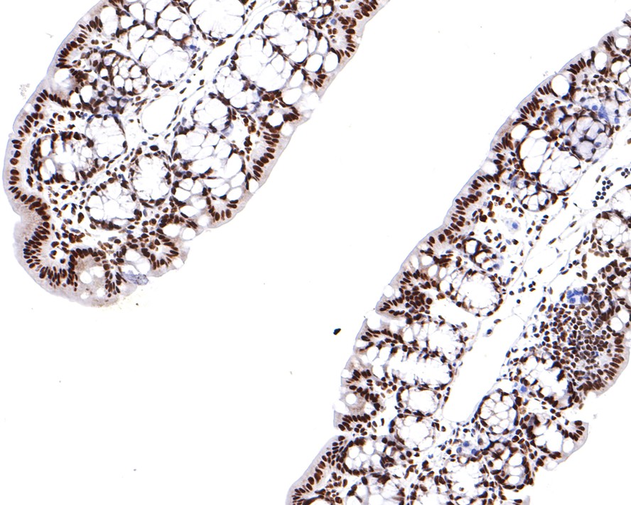 Immunohistochemical analysis of paraffin-embedded mouse large intestine tissue with Rabbit anti-PTBP1 antibody (ET7106-58) at 1/400 dilution.<br />
<br />
The section was pre-treated using heat mediated antigen retrieval with sodium citrate buffer (pH 6.0) for 2 minutes. The tissues were blocked in 1% BSA for 20 minutes at room temperature, washed with ddH2O and PBS, and then probed with the primary antibody (ET7106-58) at 1/400 dilution for 1 hour at room temperature. The detection was performed using an HRP conjugated compact polymer system. DAB was used as the chromogen. Tissues were counterstained with hematoxylin and mounted with DPX.
