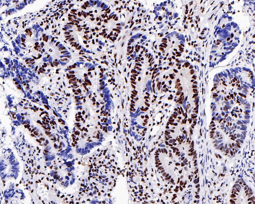 Immunohistochemical analysis of paraffin-embedded mouse large intestine tissue with Rabbit anti-Phospho-Creb (S133) antibody (ET7107-93) at 1/400 dilution.<br />
<br />
The section was pre-treated using heat mediated antigen retrieval with sodium citrate buffer (pH 6.0) for 2 minutes. The tissues were blocked in 1% BSA for 20 minutes at room temperature, washed with ddH2O and PBS, and then probed with the primary antibody (ET7107-93) at 1/400 dilution for 1 hour at room temperature. The detection was performed using an HRP conjugated compact polymer system. DAB was used as the chromogen. Tissues were counterstained with hematoxylin and mounted with DPX.