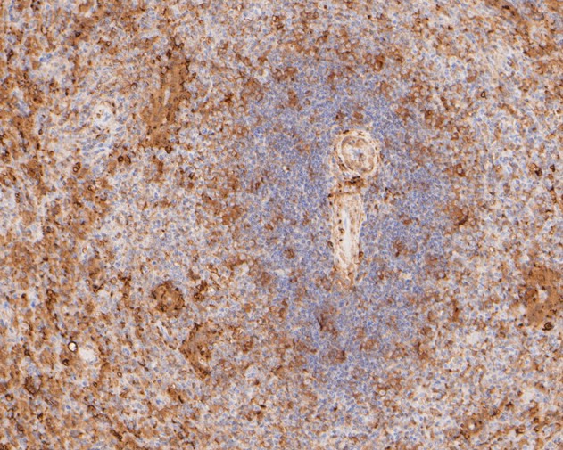 Immunohistochemical analysis of paraffin-embedded human spleen tissue using anti-Ferritin antibody. The section was pre-treated using heat mediated antigen retrieval with sodium citrate buffer (pH 6.0) for 20 minutes. The tissues were blocked in 5% BSA for 30 minutes at room temperature, washed with ddH2O and PBS, and then probed with the primary antibody (ET1610-78, 1/200)  for 30 minutes at room temperature. The detection was performed using an HRP conjugated compact polymer system. DAB was used as the chromogen. Tissues were counterstained with hematoxylin and mounted with DPX.