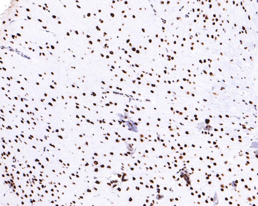 Immunohistochemical analysis of paraffin-embedded mouse brain tissue with Rabbit anti-RNF40 antibody (ET7109-46) at 1/400 dilution.<br />
<br />
The section was pre-treated using heat mediated antigen retrieval with sodium citrate buffer (pH 6.0) for 2 minutes. The tissues were blocked in 1% BSA for 20 minutes at room temperature, washed with ddH2O and PBS, and then probed with the primary antibody (ET7109-46) at 1/400 dilution for 1 hour at room temperature. The detection was performed using an HRP conjugated compact polymer system. DAB was used as the chromogen. Tissues were counterstained with hematoxylin and mounted with DPX.