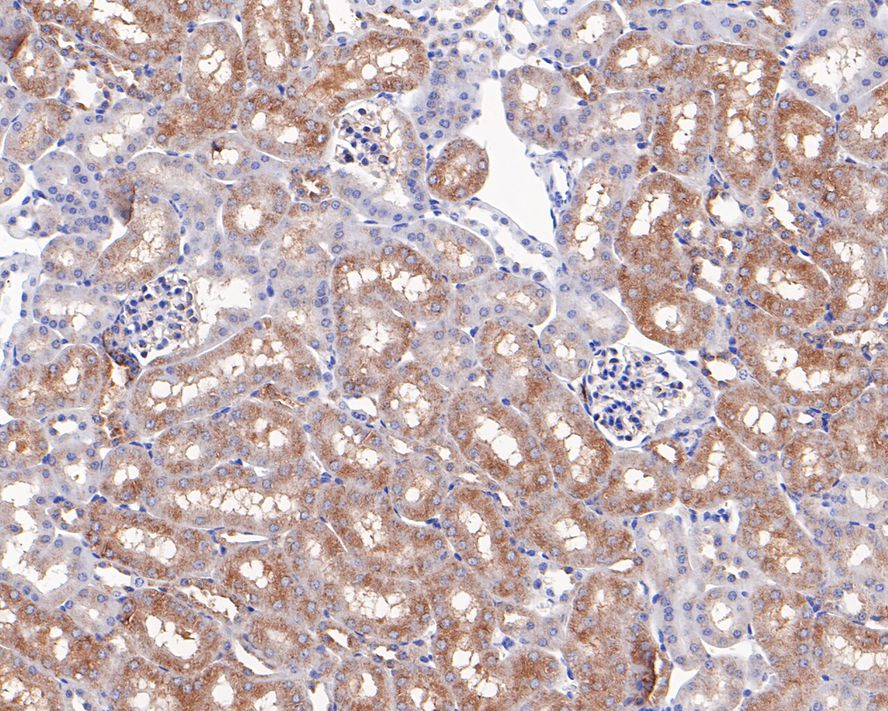 Immunohistochemical analysis of paraffin-embedded mouse brain tissue with Rabbit anti-Phospho-Tau(S396) antibody (ET1611-68) at 1/50 dilution.<br />
<br />
The section was pre-treated using heat mediated antigen retrieval with Tris-EDTA buffer (pH 9.0) for 20 minutes. The tissues were blocked in 1% BSA for 20 minutes at room temperature, washed with ddH2O and PBS, and then probed with the primary antibody (ET1611-68) at 1/50 dilution for 1 hour at room temperature. The detection was performed using an HRP conjugated compact polymer system. DAB was used as the chromogen. Tissues were counterstained with hematoxylin and mounted with DPX.
