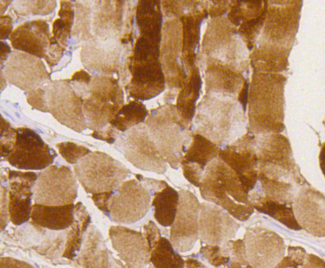 Immunohistochemical analysis of paraffin-embedded mouse smooth muscle tissue using anti-Phospho-Glycogen synthase 1(S641) antibody. The section was pre-treated using heat mediated antigen retrieval with Tris-EDTA buffer (pH 8.0-8.4) for 20 minutes.The tissues were blocked in 5% BSA for 30 minutes at room temperature, washed with ddH2O and PBS, and then probed with the primary antibody (ET1602-13, 1/50) for 30 minutes at room temperature. The detection was performed using an HRP conjugated compact polymer system. DAB was used as the chromogen. Tissues were counterstained with hematoxylin and mounted with DPX.