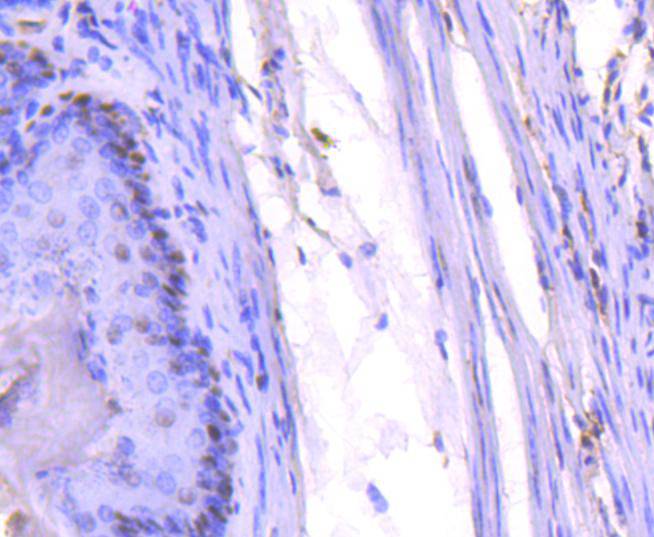 Immunohistochemical analysis of paraffin-embedded mouse stomach tissue using anti-PCNA antibody. The section was pre-treated using heat mediated antigen retrieval with Tris-EDTA buffer (pH 8.0-8.4) for 20 minutes.The tissues were blocked in 5% BSA for 30 minutes at room temperature, washed with ddH2O and PBS, and then probed with the primary antibody (ET1605-38, 1/50) for 30 minutes at room temperature. The detection was performed using an HRP conjugated compact polymer system. DAB was used as the chromogen. Tissues were counterstained with hematoxylin and mounted with DPX.