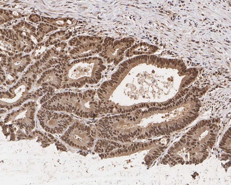 Immunohistochemical analysis of paraffin-embedded mouse testis tissue using anti-Cyclin E1 antibody. The section was pre-treated using heat mediated antigen retrieval with Tris-EDTA buffer (pH 8.0-8.4) for 20 minutes.The tissues were blocked in 5% BSA for 30 minutes at room temperature, washed with ddH2O and PBS, and then probed with the primary antibody (ET1612-16, 1/50) for 30 minutes at room temperature. The detection was performed using an HRP conjugated compact polymer system. DAB was used as the chromogen. Tissues were counterstained with hematoxylin and mounted with DPX.