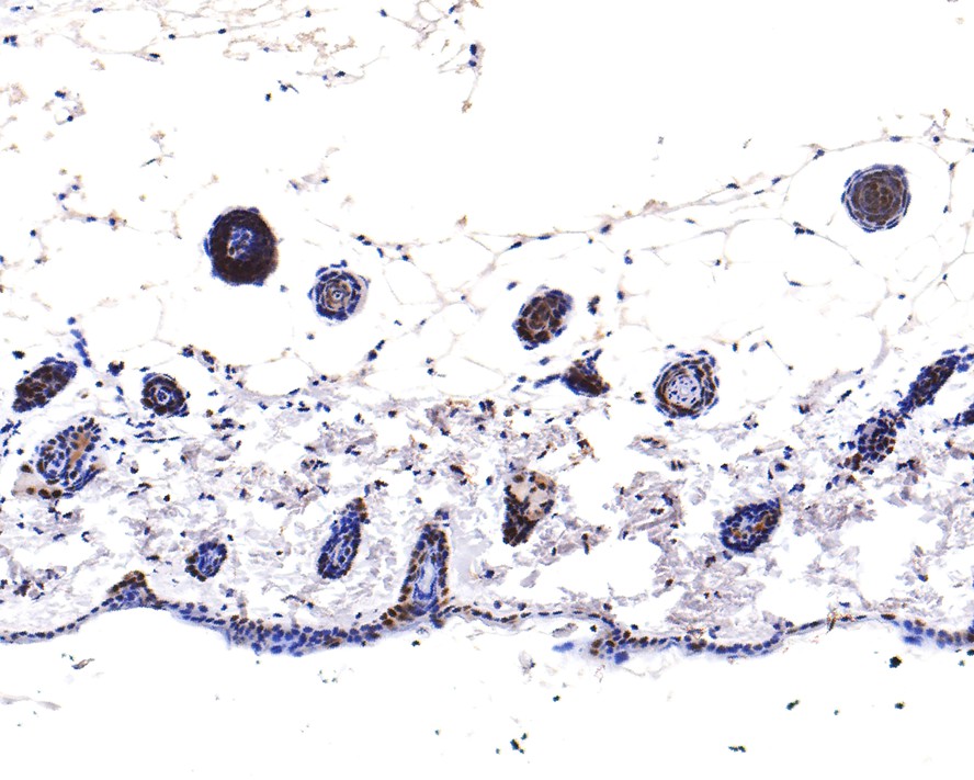 Immunohistochemical analysis of paraffin-embedded rat skin tissue with Rabbit anti-Sumo 2+3 antibody (ET1701-17) at 1/400 dilution.<br />
<br />
The section was pre-treated using heat mediated antigen retrieval with sodium citrate buffer (pH 6.0) for 2 minutes. The tissues were blocked in 1% BSA for 20 minutes at room temperature, washed with ddH2O and PBS, and then probed with the primary antibody (ET1701-17) at 1/400 dilution for 1 hour at room temperature. The detection was performed using an HRP conjugated compact polymer system. DAB was used as the chromogen. Tissues were counterstained with hematoxylin and mounted with DPX.